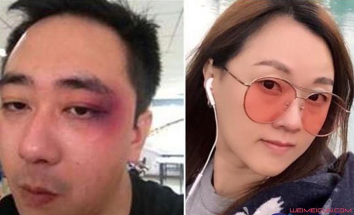 曝王自健被家暴细节 曾称是夫妻间的情趣结果却令人唏嘘